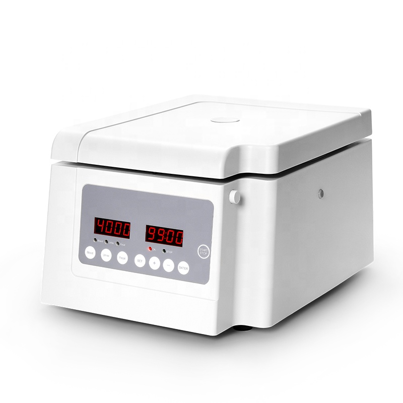 YSCF0408 良い価格の医療用遠心分離機多目的低速実験室 - Medical Lab Machine Price のレビューと価格