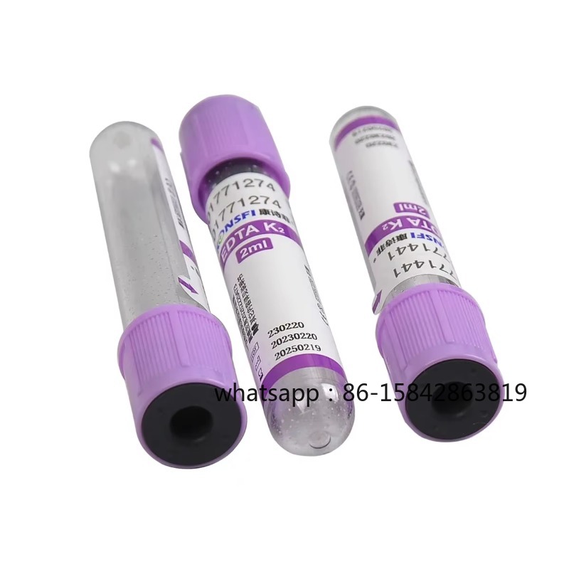 医療ラボ用真空採血凝固管/EDTAチューブ 2/3/5ML  - Blood Collection Tube のレビューと価格